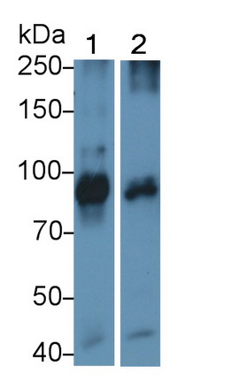 Transferrin Receptor (TFR) Human Monoclonal Antibody