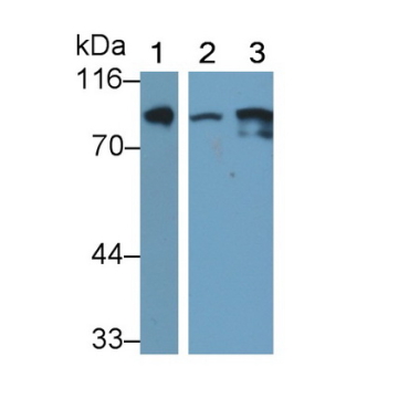 Transferrin Receptor (TFR) Human Monoclonal Antibody