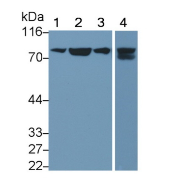 Transferrin Receptor (TFR) Human Monoclonal Antibody