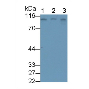 Transferrin Receptor (TFR) Human Monoclonal Antibody