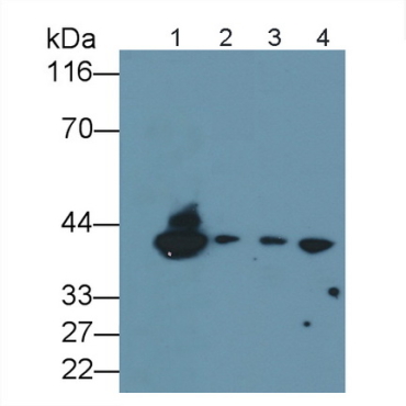 Cluster Of Differentiation 1a (CD1a) Human Monoclonal Antibody