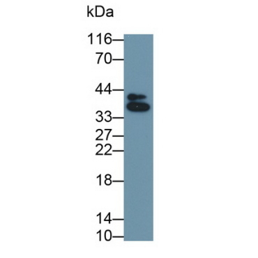 Cluster Of Differentiation 1a (CD1a) Human Monoclonal Antibody
