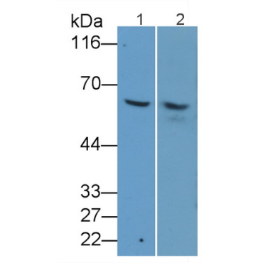 Cluster Of Differentiation 1a (CD1a) Human Monoclonal Antibody