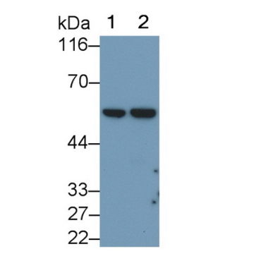 Cluster Of Differentiation 1a (CD1a) Human Monoclonal Antibody