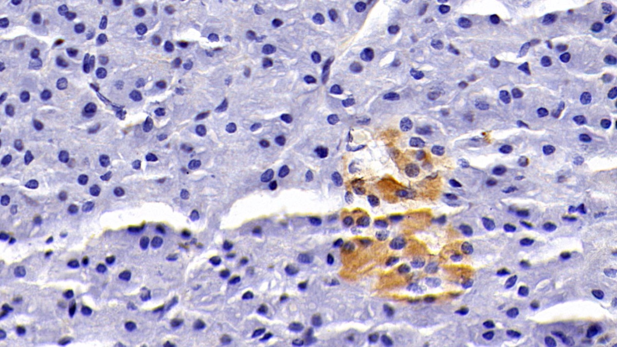 Clusterin (CLU) Rabbit Monoclonal Antibody