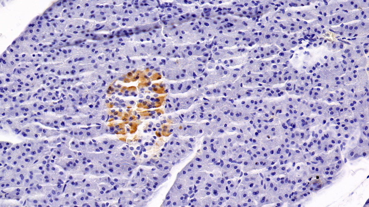 Clusterin (CLU) Rabbit Monoclonal Antibody