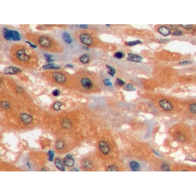 Glucose Transporter 1 (GLUT1) Human Monoclonal Antibody