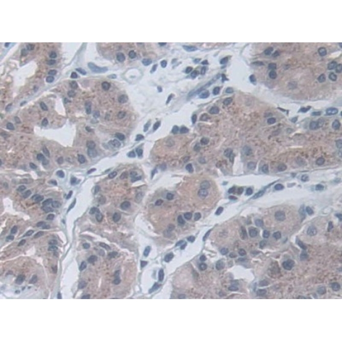 Interleukin 19 (IL19) Human Monoclonal Antibody