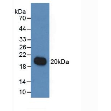 Interleukin 19 (IL19) Human Monoclonal Antibody