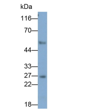 Granzyme K (GZMK) Mouse Monoclonal Antibody