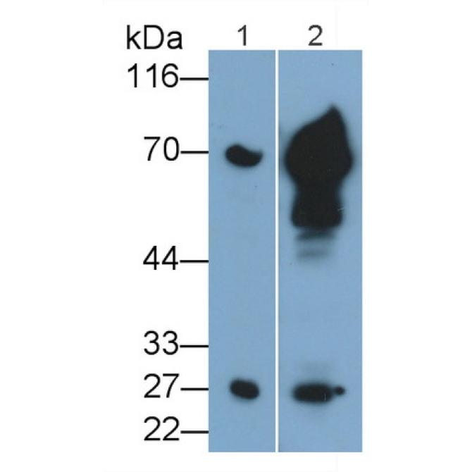 Granzyme K (GZMK) Mouse Monoclonal Antibody