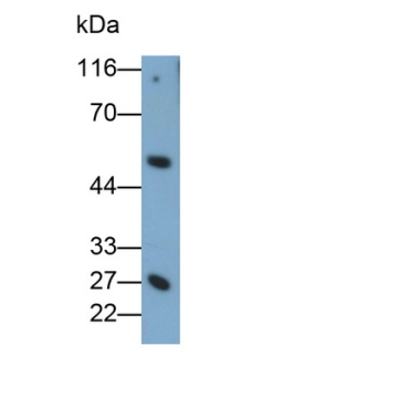 Granzyme K (GZMK) Mouse Monoclonal Antibody