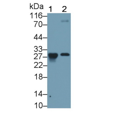 Granzyme K (GZMK) Mouse Monoclonal Antibody
