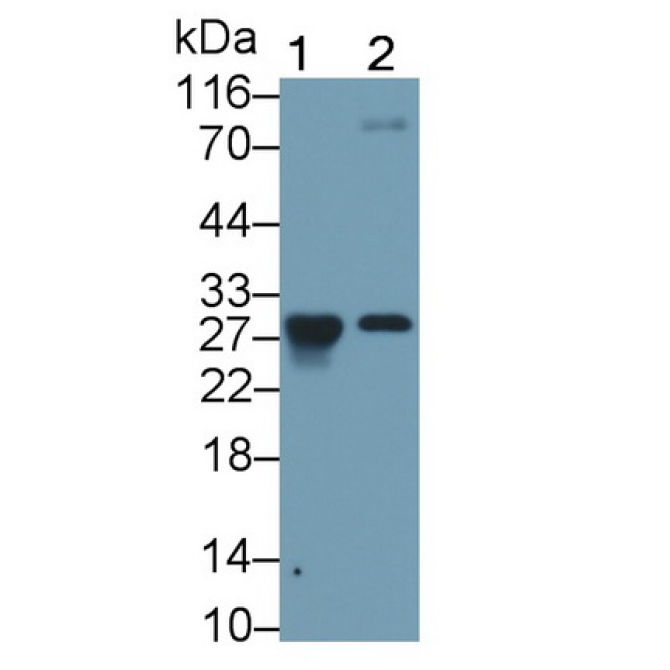 Granzyme K (GZMK) Mouse Monoclonal Antibody