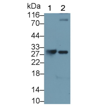 Granzyme K (GZMK) Mouse Monoclonal Antibody