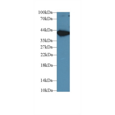 Aspartate Aminotransferase (AST) Human Monoclonal Antibody