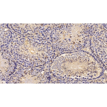 Aspartate Aminotransferase (AST) Mouse Monoclonal Antibody