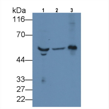 Fibrinogen Beta Chain (FGB) Human Monoclonal Antibody