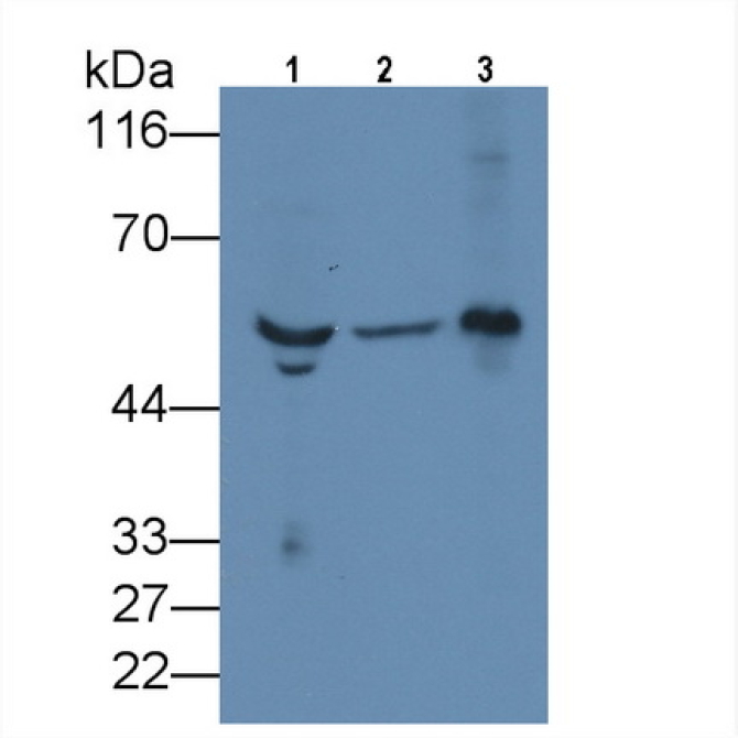 Fibrinogen Beta Chain (FGB) Human Monoclonal Antibody