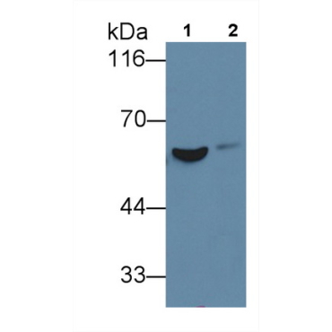 Fibrinogen Beta Chain (FGB) Human Monoclonal Antibody