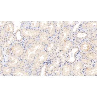 Fibrinogen Beta Chain (FGB) Human Monoclonal Antibody