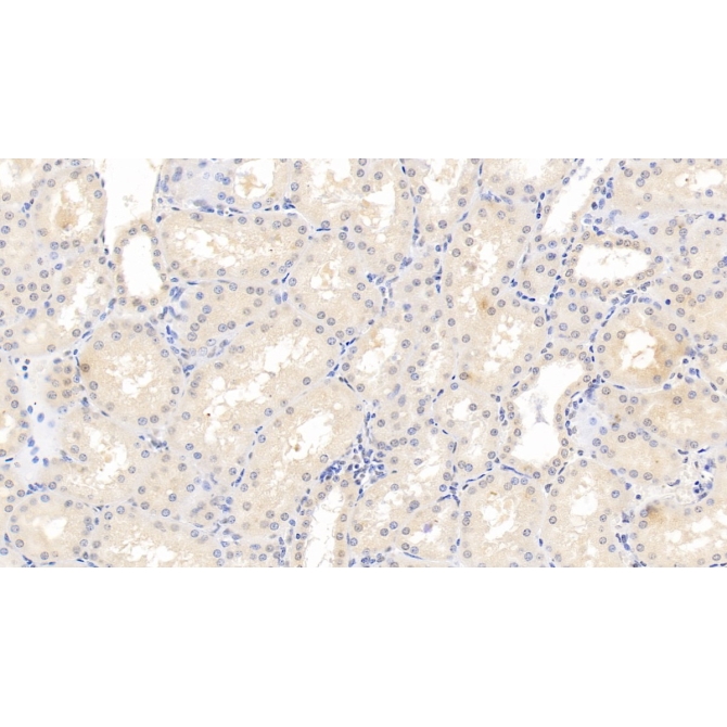 Fibrinogen Beta Chain (FGB) Human Monoclonal Antibody