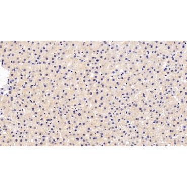 Fibrinogen Beta Chain (FGB) Human Monoclonal Antibody