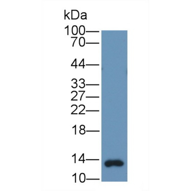 Gastrin (GT) Human Monoclonal Antibody