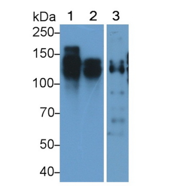 Cluster Of Differentiation 56 (CD56) Human Monoclonal Antibody