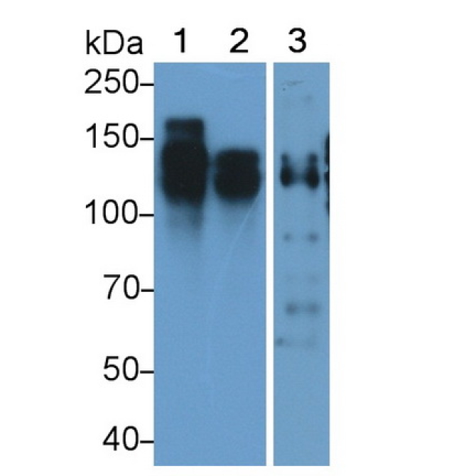 Cluster Of Differentiation 56 (CD56) Human Monoclonal Antibody