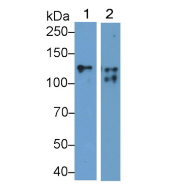 Cluster Of Differentiation 56 (CD56) Human Monoclonal Antibody