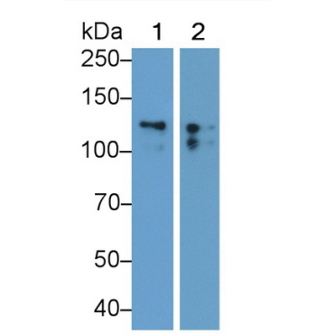 Cluster Of Differentiation 56 (CD56) Human Monoclonal Antibody