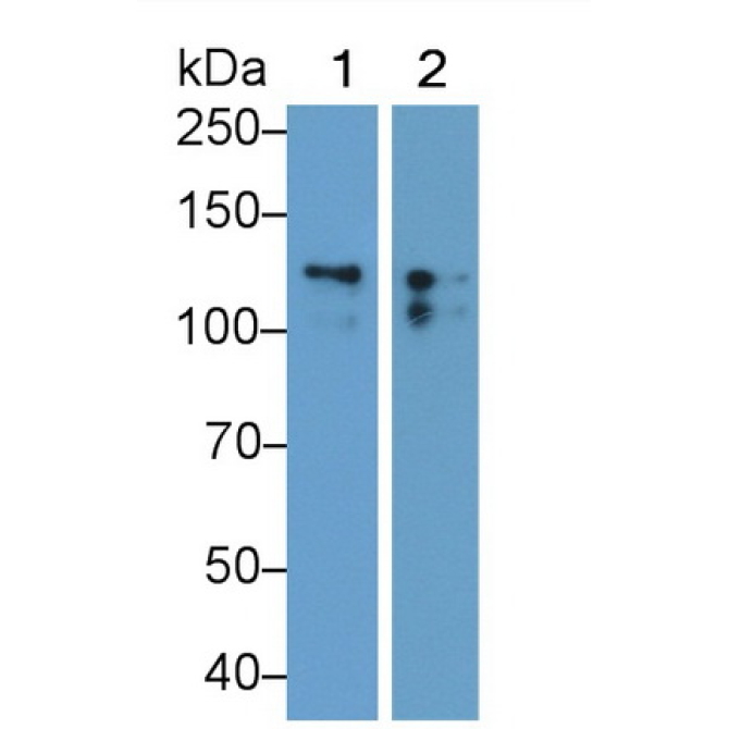 Cluster Of Differentiation 56 (CD56) Human Monoclonal Antibody