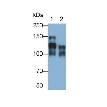 Cluster Of Differentiation 56 (CD56) Human Monoclonal Antibody