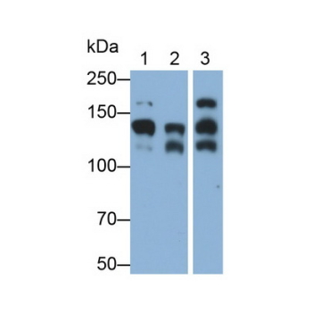 Cluster Of Differentiation 56 (CD56) Human Monoclonal Antibody