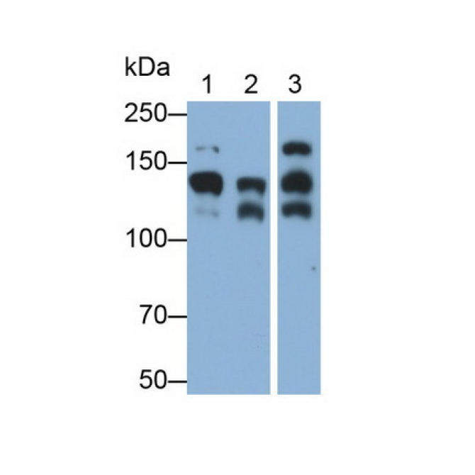 Cluster Of Differentiation 56 (CD56) Human Monoclonal Antibody