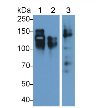 Cluster Of Differentiation 56 (CD56) Human Monoclonal Antibody