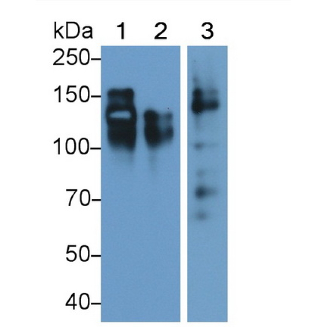 Cluster Of Differentiation 56 (CD56) Human Monoclonal Antibody