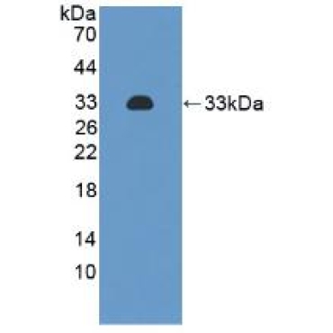 Integrin Alpha 2 (ITGa2) Human Monoclonal Antibody