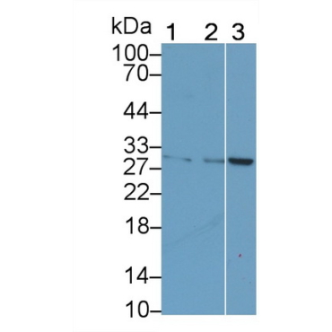 Cytotoxic T-Lymphocyte Associated Antigen 4 (CTLA4) Human Monoclonal Antibody