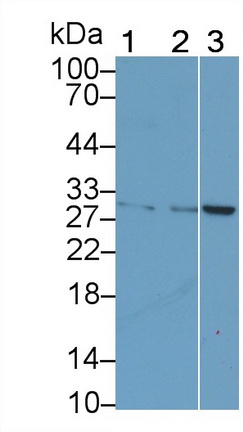 Cytotoxic T-Lymphocyte Associated Antigen 4 (CTLA4) Human Monoclonal Antibody