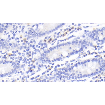 Cytotoxic T-Lymphocyte Associated Antigen 4 (CTLA4) Human Monoclonal Antibody