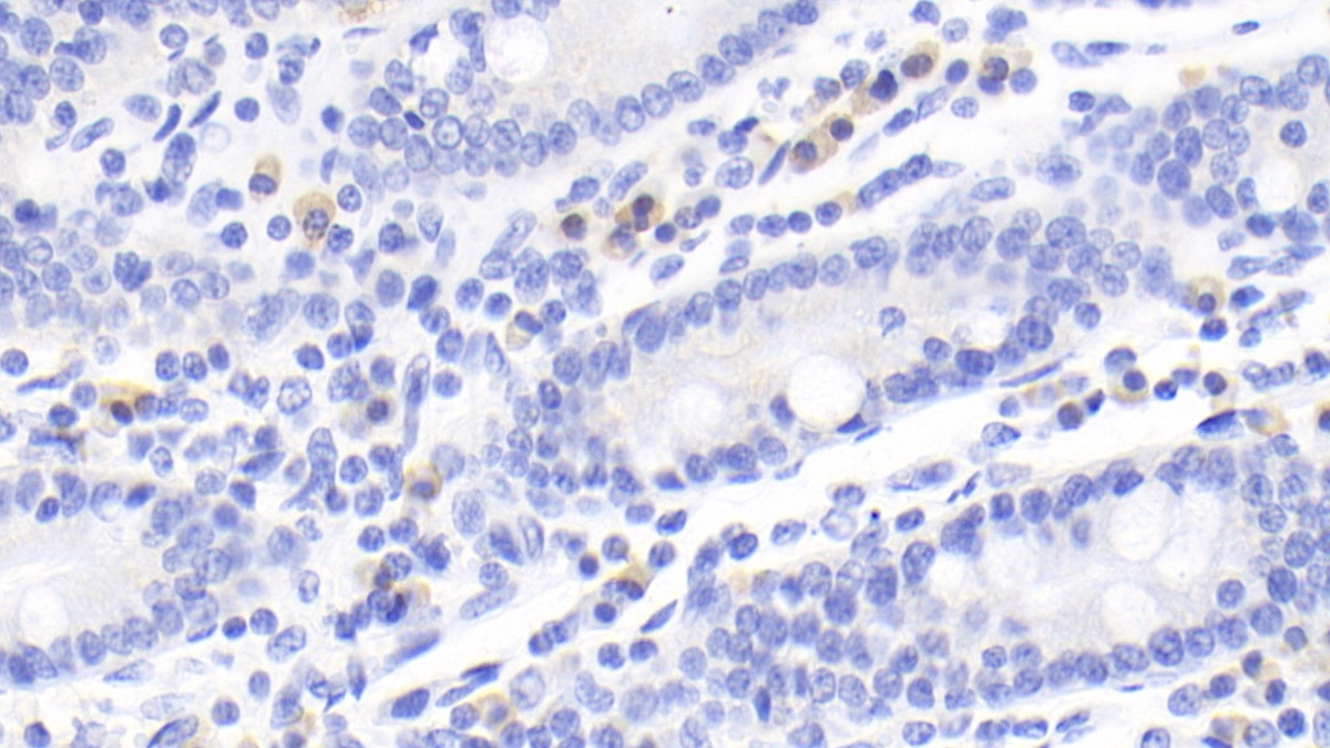 Cytotoxic T-Lymphocyte Associated Antigen 4 (CTLA4) Human Monoclonal Antibody