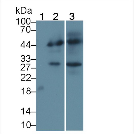Cytotoxic T-Lymphocyte Associated Antigen 4 (CTLA4) Human Monoclonal Antibody