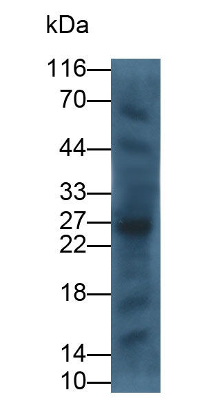 Cytotoxic T-Lymphocyte Associated Antigen 4 (CTLA4) Human Monoclonal Antibody