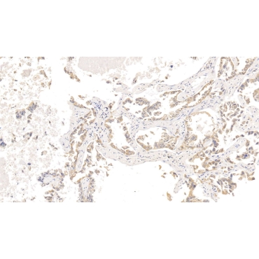 Cytokeratin 18 (CK18) Human Monoclonal Antibody