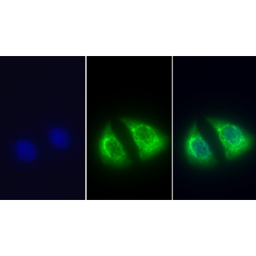 Cytokeratin 18 (CK18) Human Monoclonal Antibody
