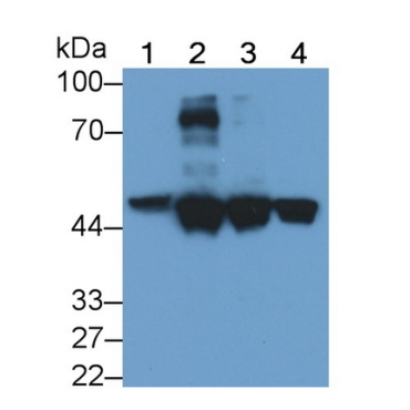 Cytokeratin 18 (CK18) Human Monoclonal Antibody