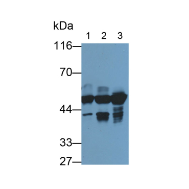 Cytokeratin 18 (CK18) Human Monoclonal Antibody