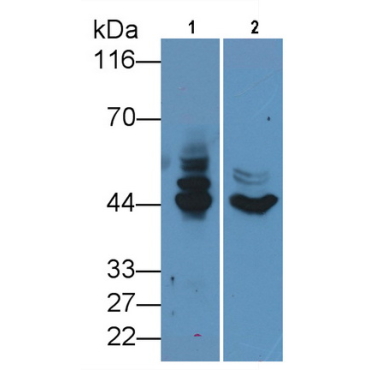 Cytokeratin 19 (CK19) Human Monoclonal Antibody